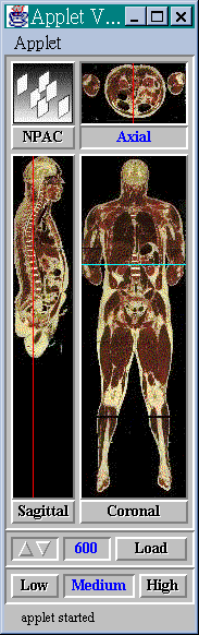 The Visual Human Viewer