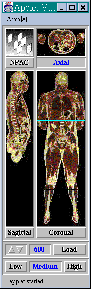 The Visual Human Viewer. Main Panel